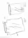 Fig. 52 - Pneumoperitoneum device