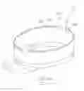 Fig. 72 - Pneumoperitoneum device