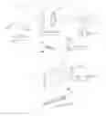 Fig. 80 - Pneumoperitoneum device