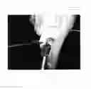 Fig. 02 - Arthroscopic biceps tenodesis in continuity