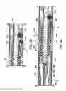 Fig. 28 - Disposable loading unit for use with a surgical instrument
