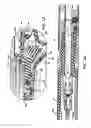 Fig. 32 - Disposable loading unit for use with a surgical instrument