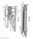 Fig. 35 - Disposable loading unit for use with a surgical instrument