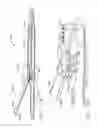 Fig. 75 - Disposable loading unit for use with a surgical instrument