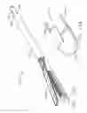 Fig. 79 - Disposable loading unit for use with a surgical instrument