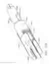 Fig. 85 - Disposable loading unit for use with a surgical instrument