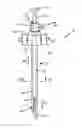 Fig. 01 - Apparatus and methods for closing vessels