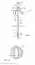 Fig. 02 - Apparatus and methods for closing vessels