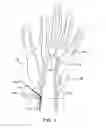 Fig. 02 - Radial artery device