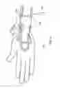 Fig. 06 - Radial artery device