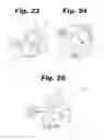 Fig. 18 - Patient matched instrument
