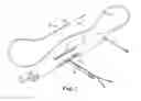 Fig. 02 - Spin-to-open atherectomy device with electric motor control