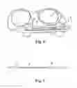 Fig. 06 - Spin-to-open atherectomy device with electric motor control