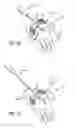 Fig. 04 - Method and apparatus for thread transection of a ligament