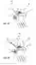 Fig. 05 - Method and apparatus for thread transection of a ligament