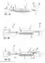 Fig. 08 - Method and apparatus for thread transection of a ligament