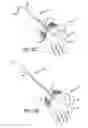 Fig. 12 - Method and apparatus for thread transection of a ligament
