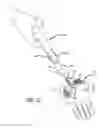 Fig. 17 - Method and apparatus for thread transection of a ligament