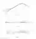 Fig. 02 - INTEGRATED UTERINE MANIPULATOR AND SENSOR AND METHOD
