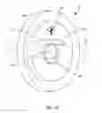 Fig. 06 - DYNAMIC SPINAL STABILIZATION ROD