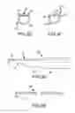 Fig. 04 - METHODS AND APPARATUS FOR ACCESSING AND TREATING THE FACET JOINT