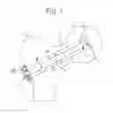 Fig. 02 - Device for fixation of bone fragments at bone fractures