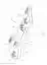 Fig. 02 - Apparatus for the constant-angle fixation and compression of a fracture or osteotomy of a bone