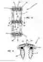 Fig. 04 - Anterior cervical plate