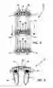 Fig. 05 - Anterior cervical plate