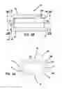 Fig. 18 - Anterior cervical plate