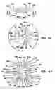 Fig. 26 - Anterior cervical plate