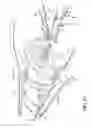 Fig. 22 - Methods, devices and therapeutic platform for automated, selectable, soft tissue resection