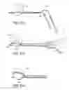 Fig. 32 - Methods, devices and therapeutic platform for automated, selectable, soft tissue resection