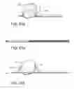 Fig. 33 - Methods, devices and therapeutic platform for automated, selectable, soft tissue resection