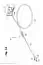 Fig. 02 - Renal denervation system