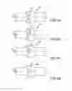 Fig. 05 - Irrigated ablation catheter having a flexible manifold