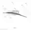 Fig. 13 - Characterizing ablation lesions using optical coherence tomography (OCT)