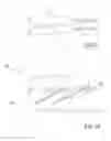Fig. 07 - Post nasal drip treatment