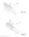 Fig. 10 - Post nasal drip treatment