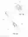 Fig. 18 - Post nasal drip treatment