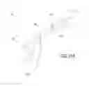 Fig. 20 - Post nasal drip treatment