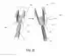 Fig. 26 - Post nasal drip treatment