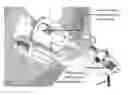 Fig. 01 - Image-guide therapy of a tissue
