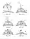 Fig. 03 - Stereotactic access devices and methods