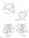 Fig. 06 - Stereotactic access devices and methods