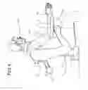 Fig. 05 - Arm support apparatus