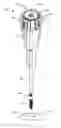 Fig. 01 - Torque limiting instrument