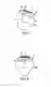 Fig. 04 - Orthodontic Bracket With Locking Shutter Extension