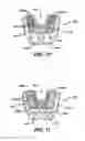 Fig. 08 - Oral care cleaning and treating device
