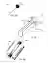 Fig. 16 - Method and apparatus for repairing a hernia